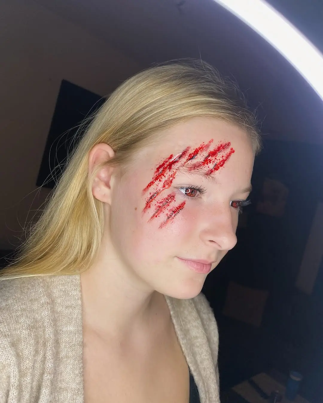 SFX wonden